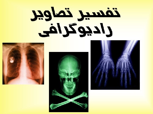 پاورپوینت تفسیر تصاویر رادیوگرافی